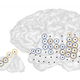 Illustration for article titled Scientists Mapped Activity In The Brain Of A Tinnitus Sufferer